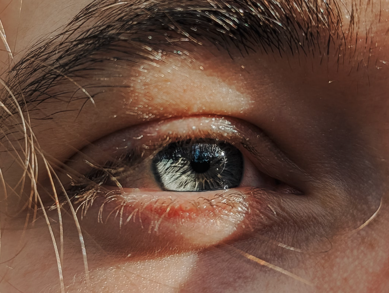 How to Get Rid of Dark Circles: Causes, Prevention & Treatments