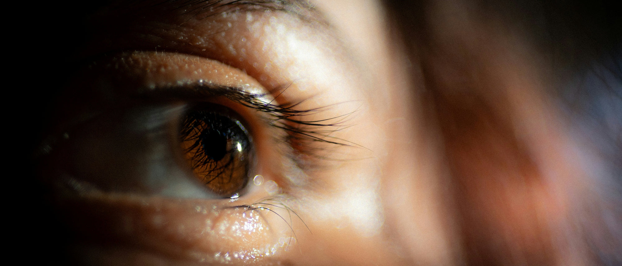 
                  Dry Eyelid Treatments You Might Not Know Of
                