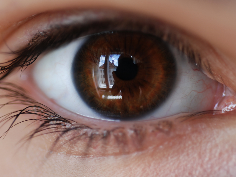Are Your Eyes Looking Smaller with Age? Here’s Why