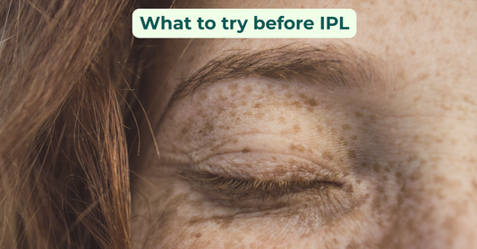 ipl-for-dry-eyes-what-it-costs-and-what-to-try-first