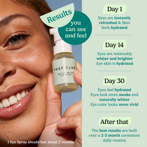 Instant Relief Eye Spray--3