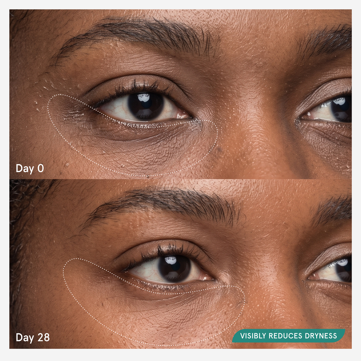 Before and after comparison at day 0 and day 28 showing visibly reduced dryness around the eyes--9