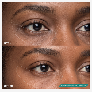 Before and after comparison at day 0 and day 28 showing visibly reduced dryness around the eyes--9