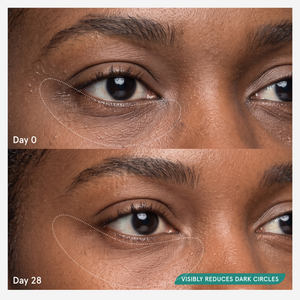 Dry Under Eye Correcting Lidstick™ - THIS ONE--7