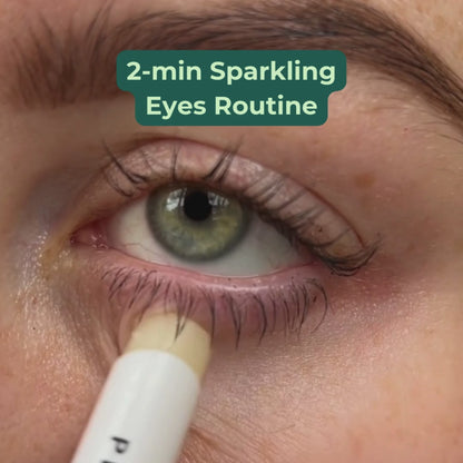 Soothing under eye treatment for dry eye symptoms and under eye bags